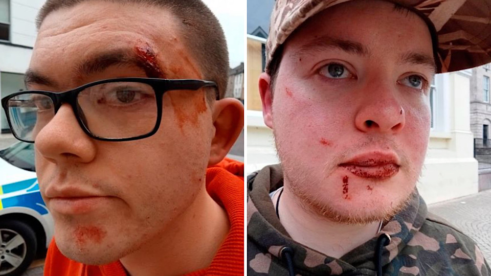Horror as young man with Asperger’s and brother beaten outside cinema by gang of 20 men